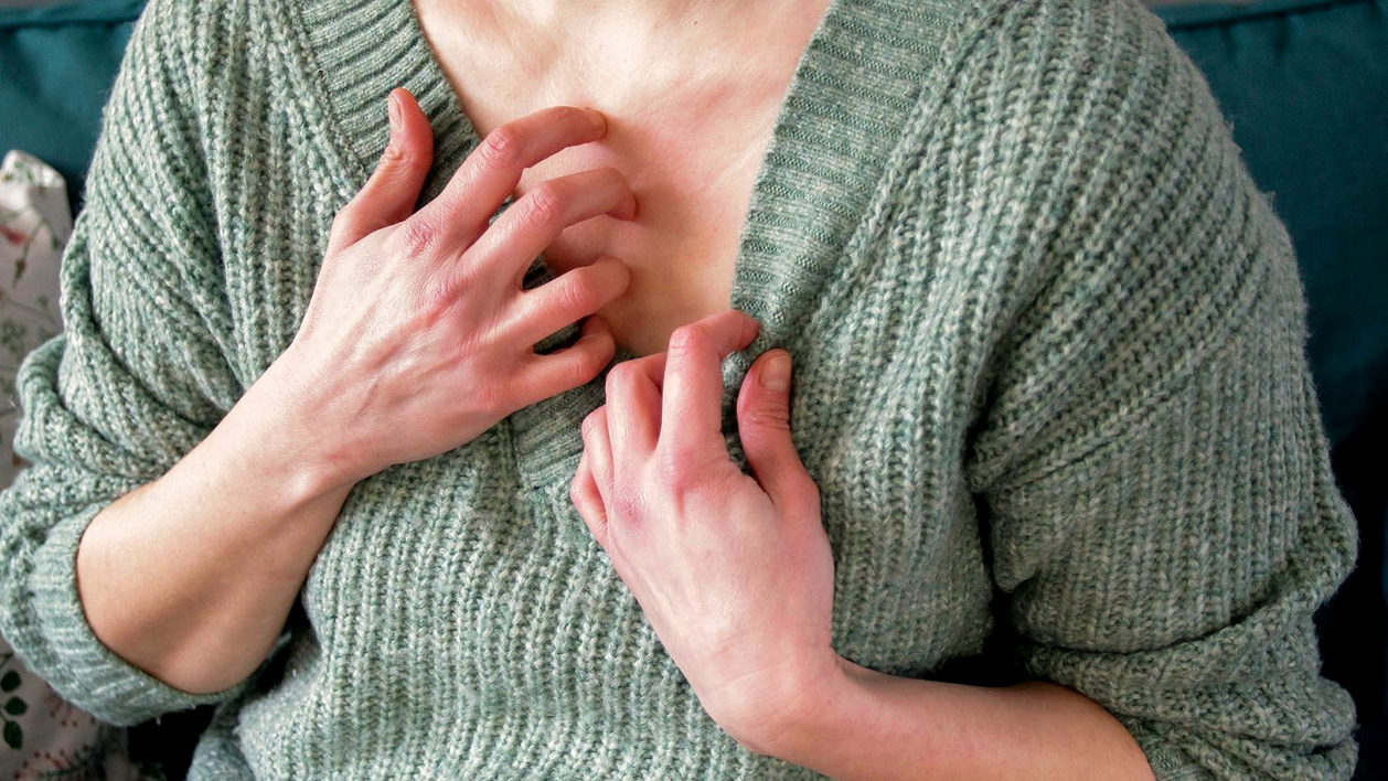 Przewlekła pokrzywka i stres – niewidoczny związek między psychiką a objawami skórnymi