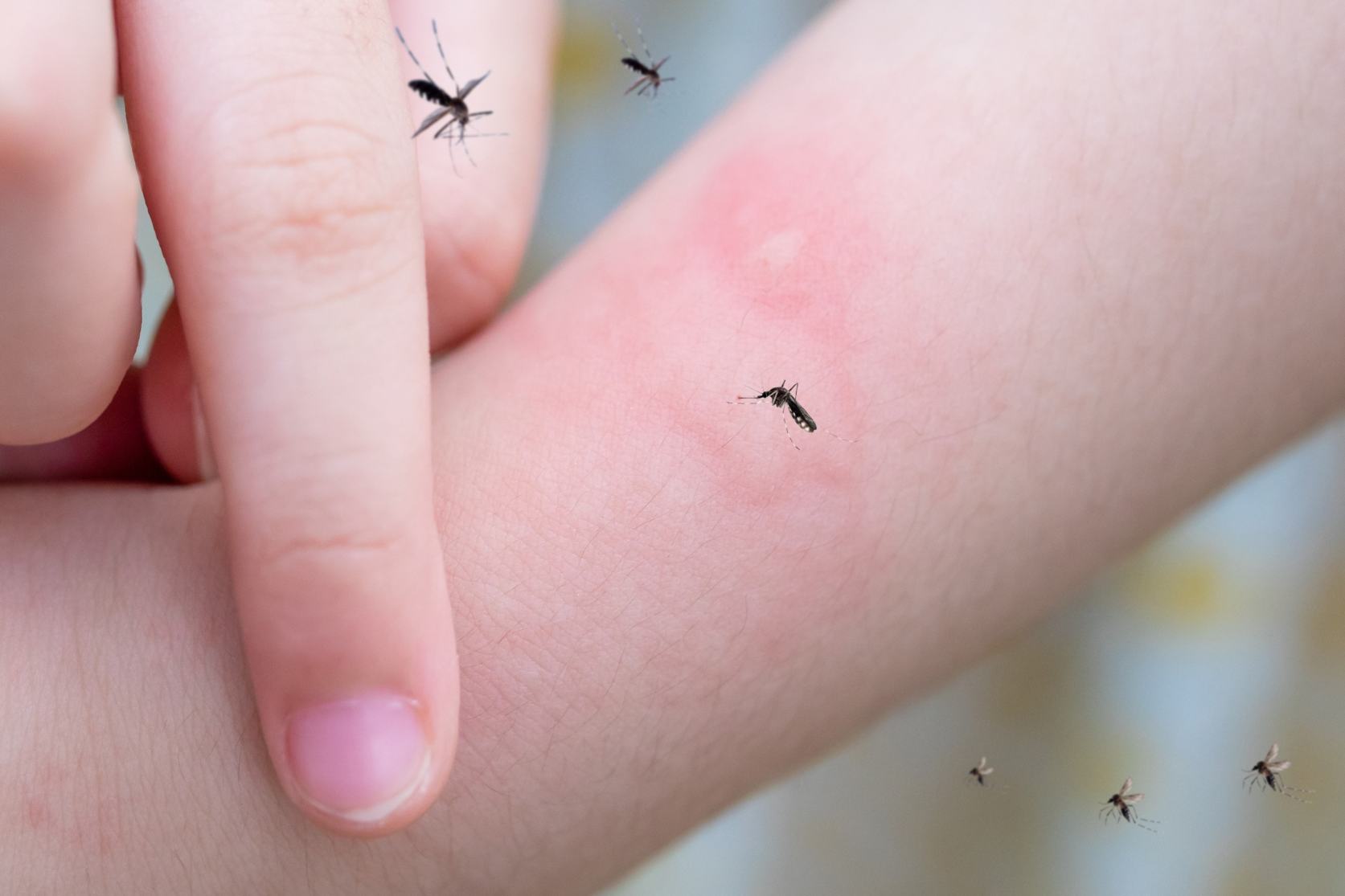 Alergia na jad pszczoły po użądleniu – kiedy użyć adrenaliny?