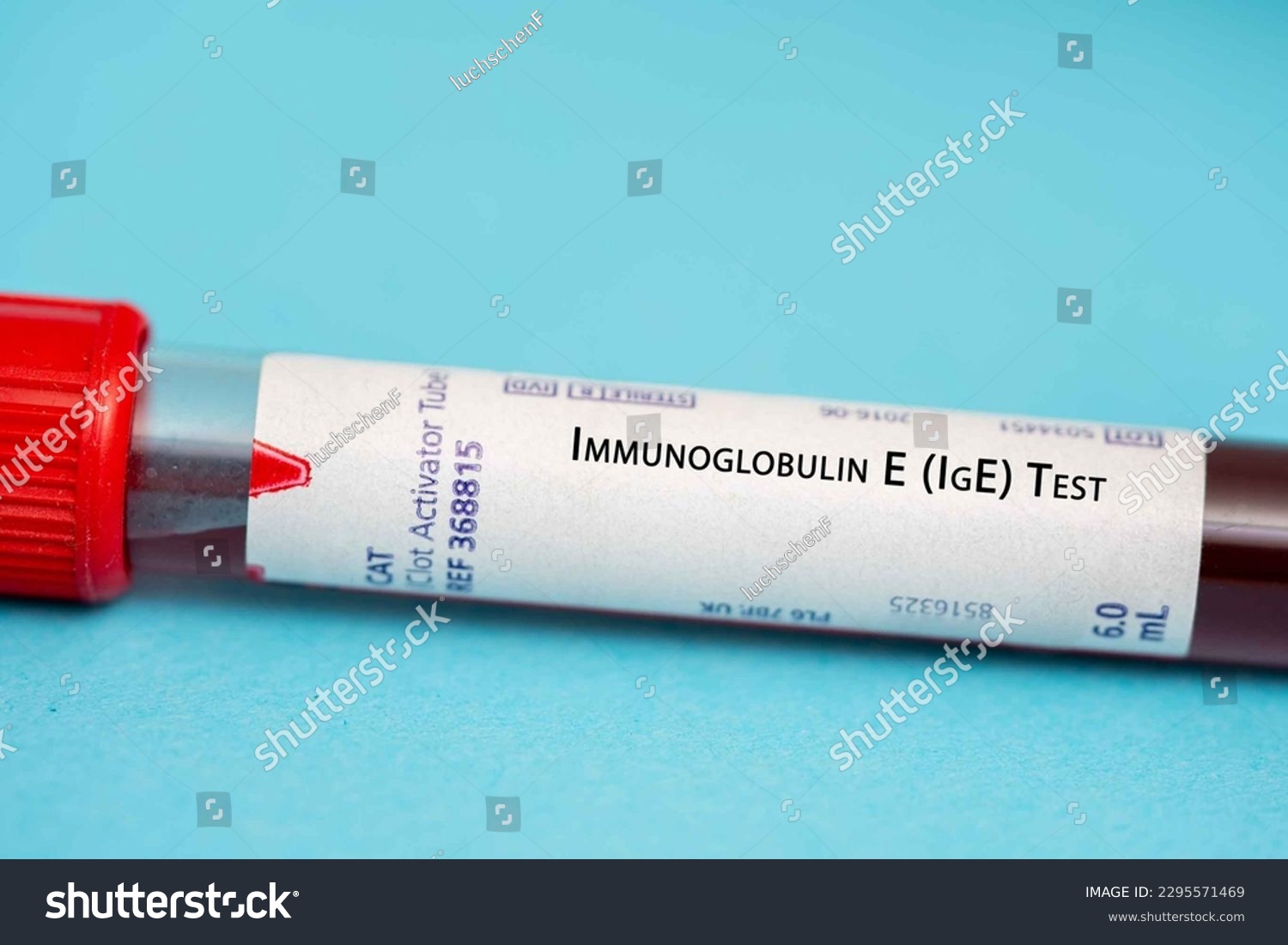 badanie poziomu przeciwciał ige we krwi